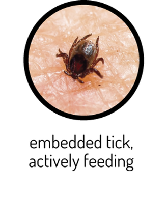 Picture of embedded tick